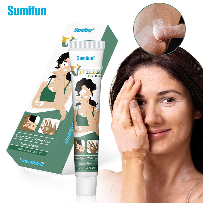 Vitiligo Treatment Ointment