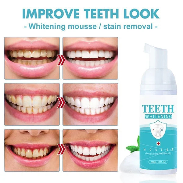 👨‍⚕TEETH WHITENING MOUSSE🔥