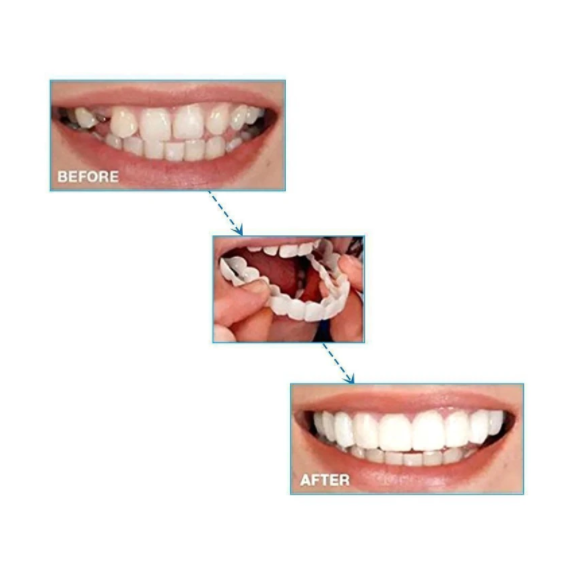 Magic Smile Teeth Brace 【Can drinking+Can eatting】