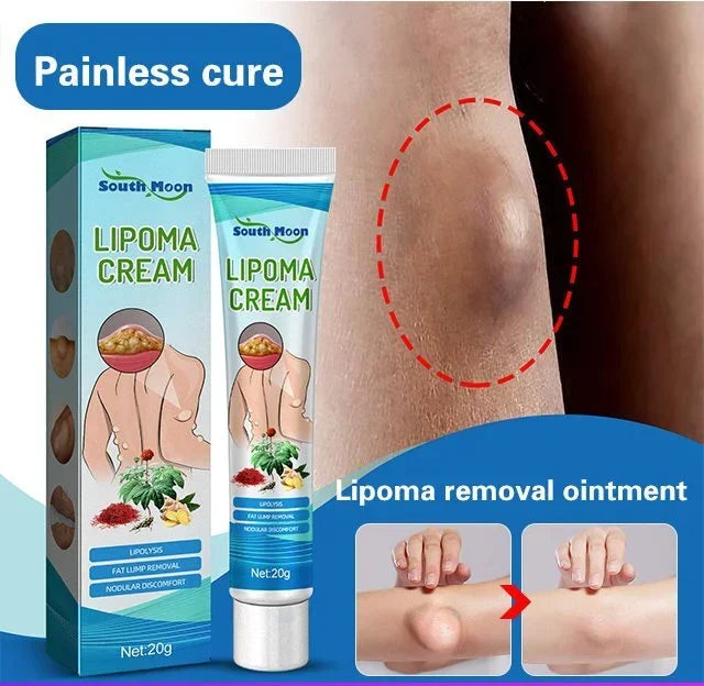 [Latest new fast-acting product] lipoma removal ointment