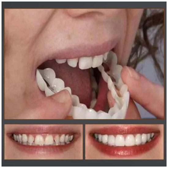 Magic Smile Teeth Brace 【Can drinking+Can eatting】