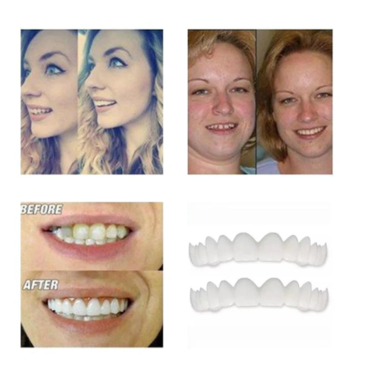 Magic Smile Teeth Brace 【Can drinking+Can eatting】