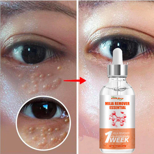 DermaPRO™ - Quickly Remove Milia | Fatty Eye Serum