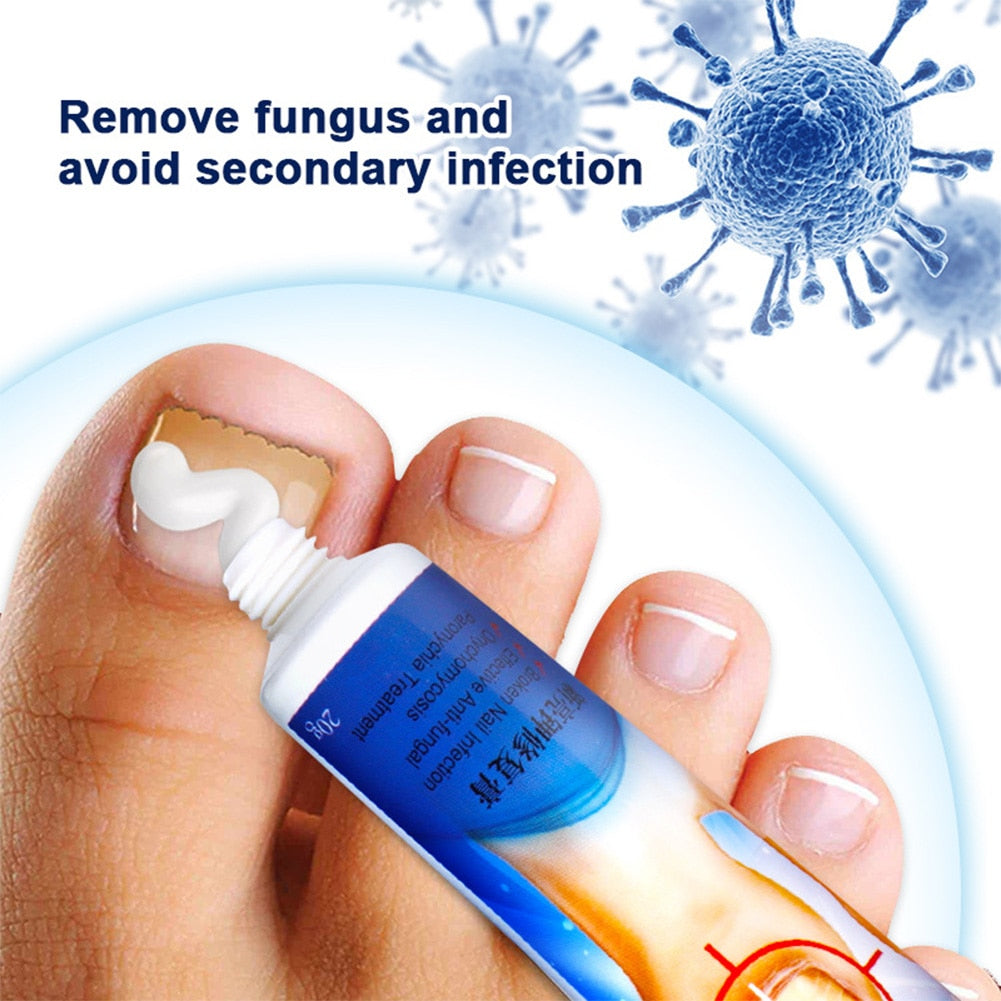 Nail Fungus Repair Cream to Promote New Nail Growth